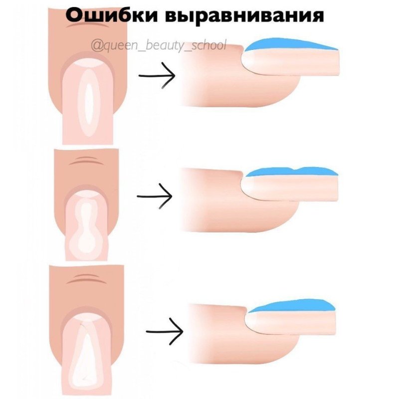 Схема выравнивания ногтевой пластины базой