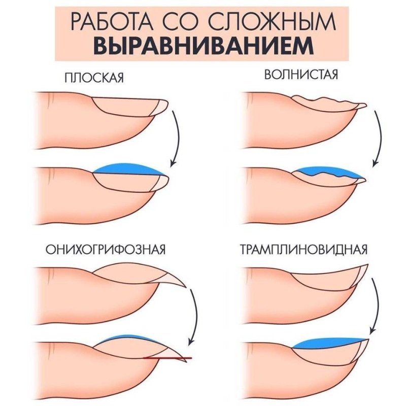 Выравнивание ногтевой пластины схема