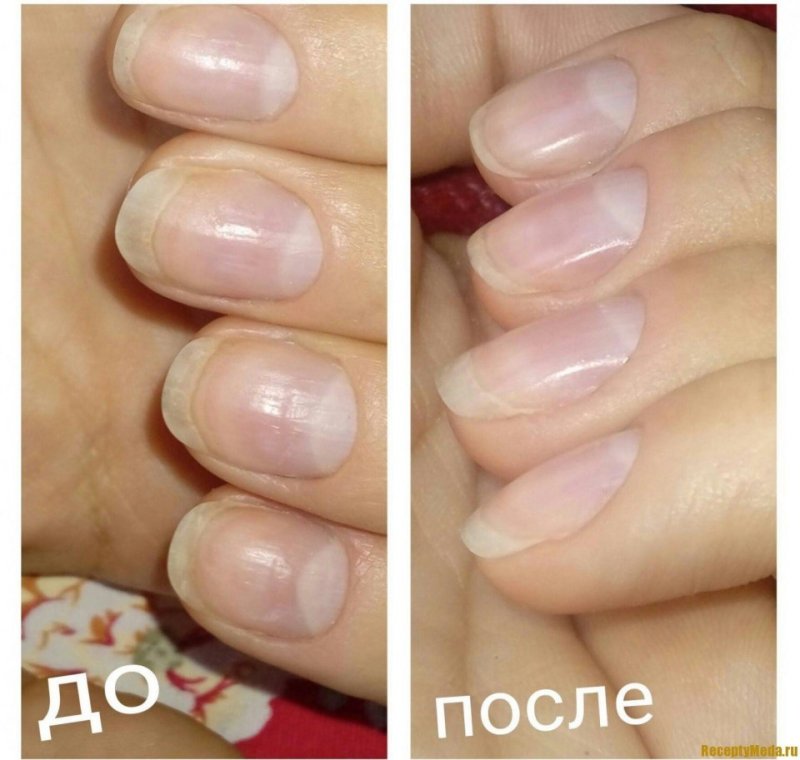 Маникюр до и после