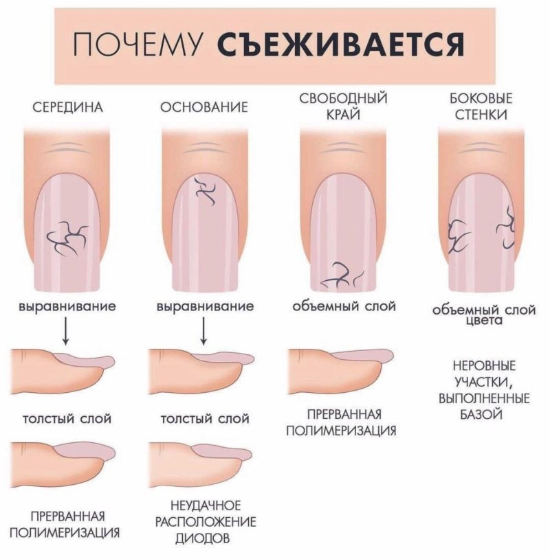 Выравнивание ногтевой пластины схема