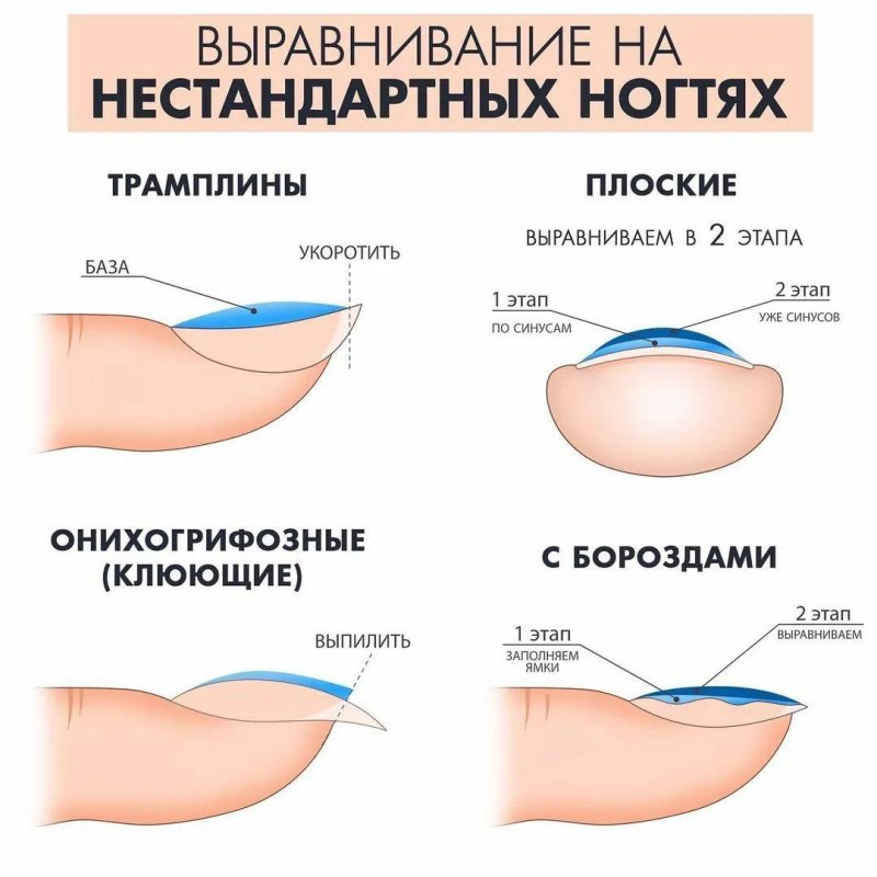 Выравнивание ногтевой пластины базой