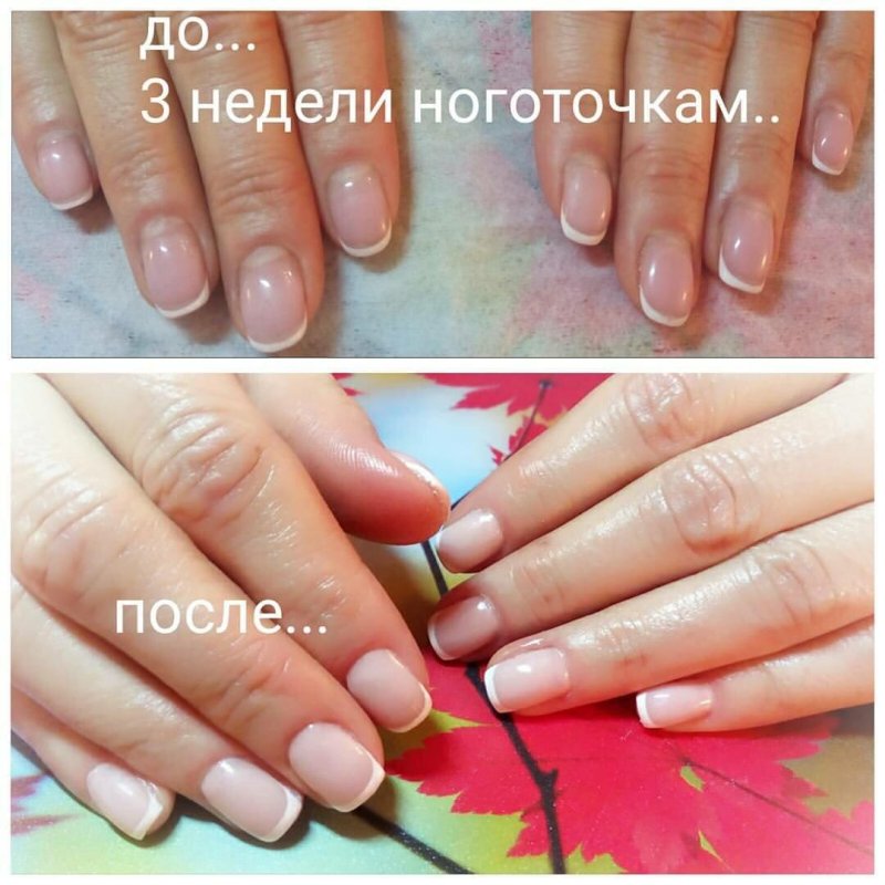 Ногти до и после