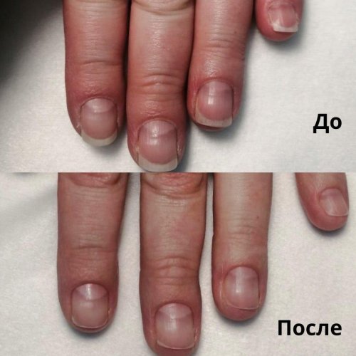 Ногти очень короткие