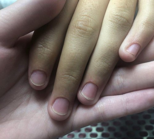Короткие ногти без маникюра