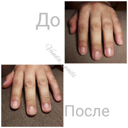 Мужской маникюр до и после