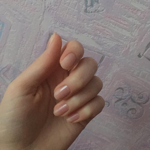Ногти под корень